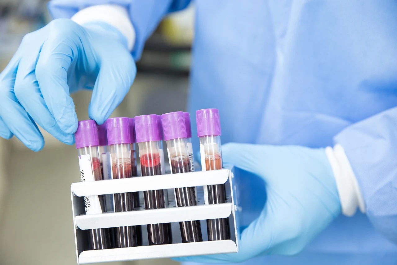Lab worker in blue gloves holds a rack of blood sample tubes used for hepatitis B and C testing