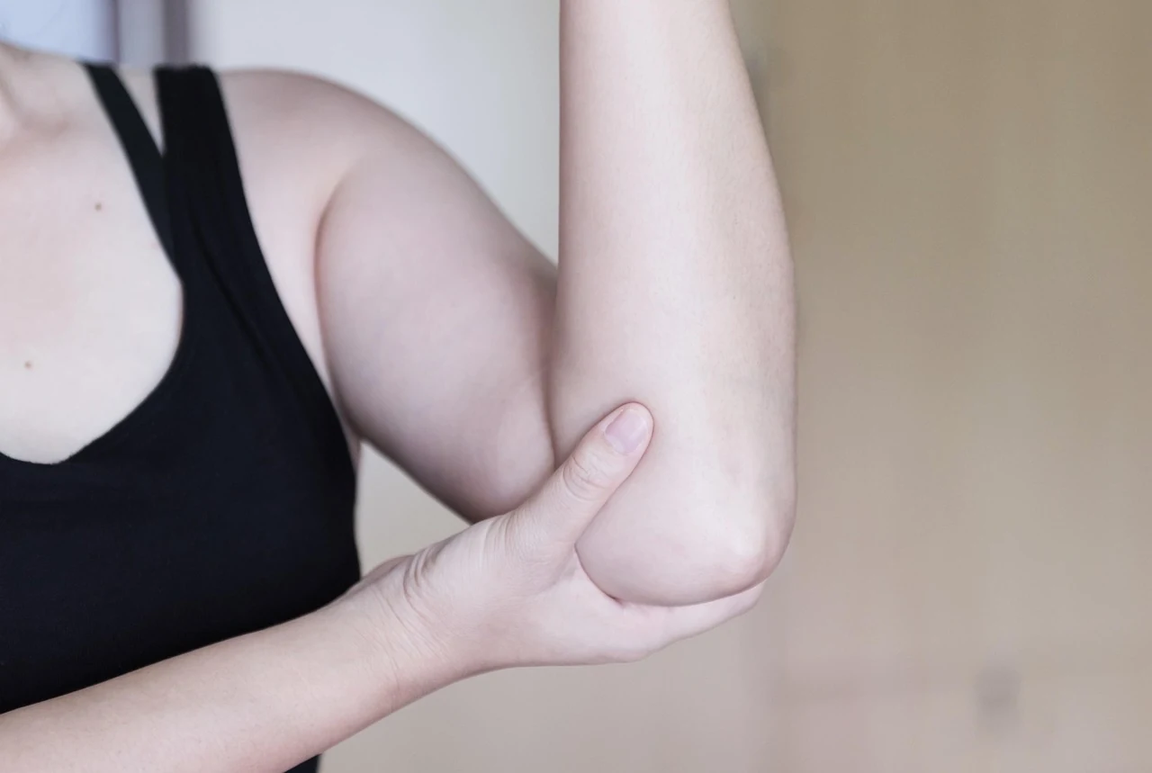 Woman in a black tank top holds her elbow to check the skin, a common spot for psoriasis patches
