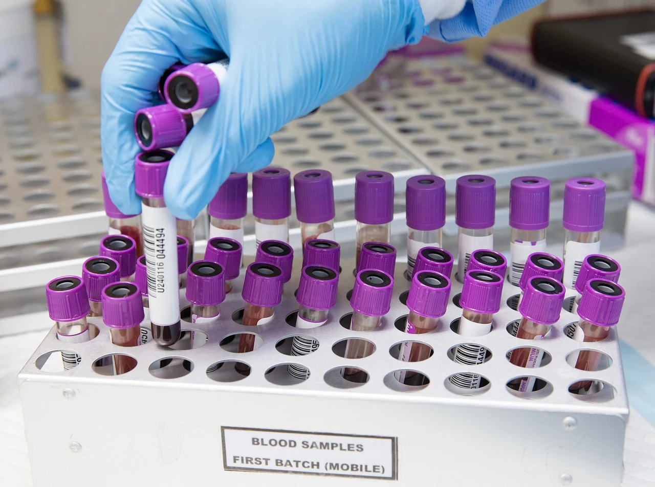 Gloved hand lifts a purple-capped tube from a rack of blood samples, used to test blood sugar levels