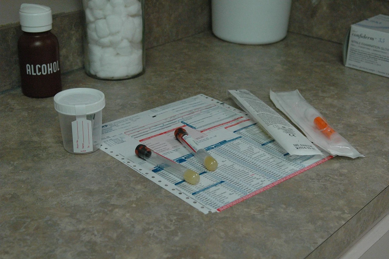 Urine cup, blood tubes, and a lab request form lie on a counter, the tests ordered when cystitis is suspected