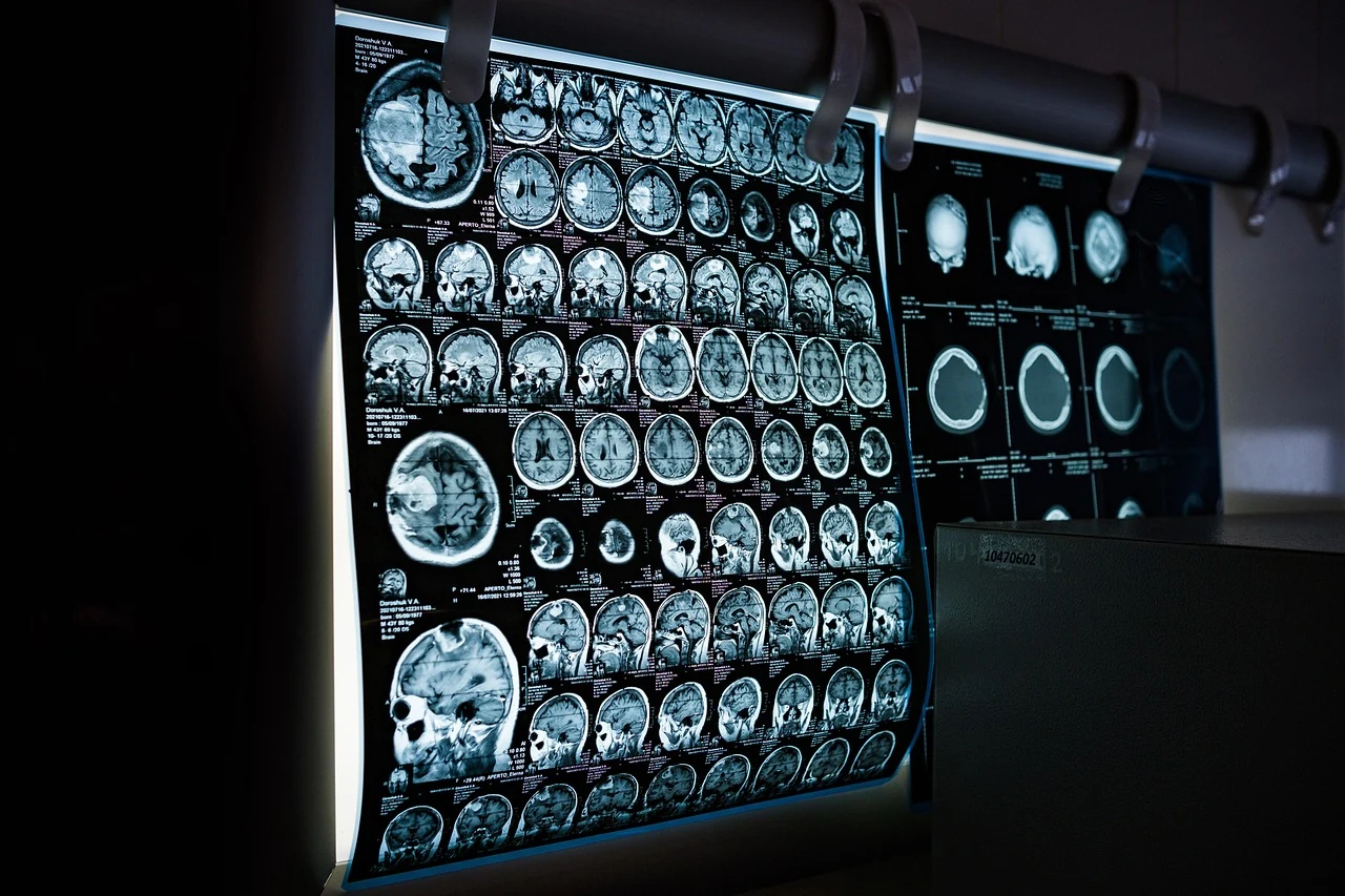 Dark viewing screen with tomography scans in a clinic room where a doctor reviews test results, including dermatology